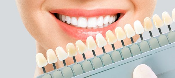 DOUBTS ABOUT TEETH WHITENING NEED TO CLARIFY post thumbnail image