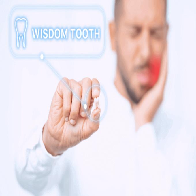 All You Need To Know About Wisdom Tooth Removal post thumbnail image